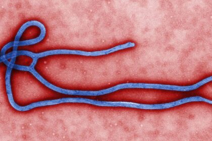 homem-vindo-de-uganda-e-isolado-no-rio-por-suspeita-de-ebola