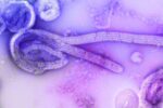 sp-descarta-segundo-caso-suspeito-de-ebola;-paciente-segue-internada